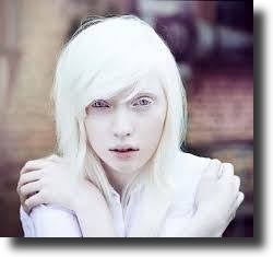 albino